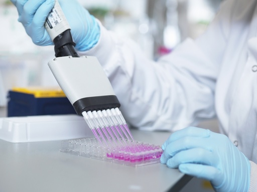 [E-90PMG] Mouse Plasminogen ELISA Kit   